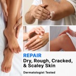 Private Label Urea Cream 40% Salicylic Acid 2% Tea Tree Oil Foot Cream for Dry Cracked Heels Feet Knees Elbows Hands