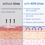 OEM Organic Feet Skin Care Cream Urea 40% Foot Salicylic Acid 2% Repair Cream Moisturizing Soften Cracked Heels