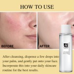 Private Label Vegan Natural Formula Witch Hazel Calming Skin Pore Minimizing Soothing Facial Toner