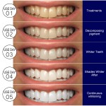 Teeth Whitening Strips Manufacturer - Residue Free