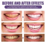 Teeth Whitening Powder Supplier - Plaque Remove
