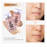 Concealer Supplier - Brighten Skin Tone OEM