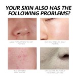 Skin Repair Foundation Manufacturer - Spot Cover