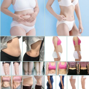 Caffeine Cream Factory - Fat Burning Anti Cellulite