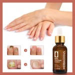 Nail Treatment Serum Manufacturer - Anti Fungal