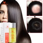Hair Care Serum Manufacturer - Anti Hair Loss