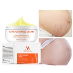 Acne Scar Cream Manufacturer - Tummy Tuck