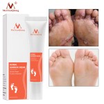 Foot Scrub Supplier - Herbal Anti Fungal