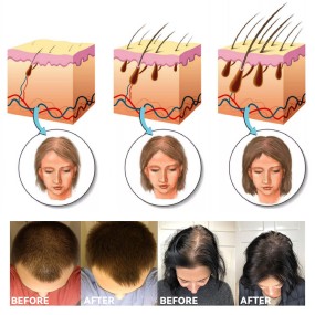 Hair Volume Powder Supplier - Ginger Extract Styling