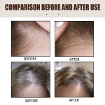 Scalp Serum Supplier - Hair Root Strengthening