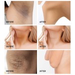 Whitening Cream Supplier - Sensitive Areas