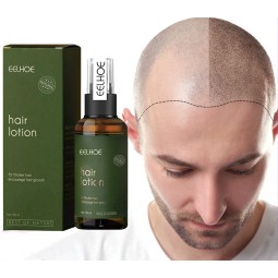 Hair Growth Oil Manufacturer - Rosemary Essential