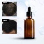 Hair Growth Oil Manufacturer - Custom TCM Essential Oil