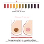 Intimate Area Lightening Cream Supplier - Custom Melanin Reduction