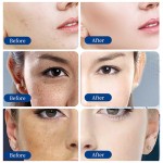 Oligopeptide Powder Supplier - Anti-Aging Facial Care