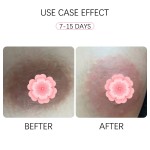 Nipple Whitening Cream Factory - OEM Custom Plant Extract