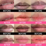 Microcrystalline Instrument Supplier - Beauty Salon Equipment