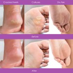 Foot Spa Kit Manufacturer - Vegan Exfoliating Jelly