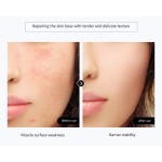 Gypsum Face Mask Factory - V Shape Lifting Custom