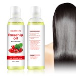 Rosehip Essential Oil Manufacturer - Natural Whitening Moisturizer