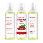 Rosehip Essential Oil Manufacturer - Natural Whitening Moisturizer