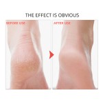 Foot Bath Set Manufacturer - 4 in 1 Spa Kit