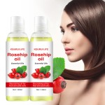 Rosehip Oil Supplier - Anti-Aging Skin Care Oil