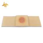 Salicylic Acid Foot Patch Supplier - Custom Corn Remover Plaster