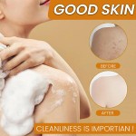 Goat Milk Soap Supplier - Anti Acne Bulk