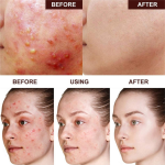 OEM/ODM Skin care set