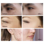 Anti Aging Set Manufacturer - Fast Acting Peptide