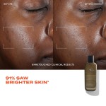 Acne Care Kit Supplier - Oily Skin Sebum