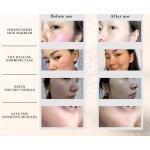 Anti Redness Kit Supplier - DNA Sodium Herbal