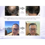 Scalp Treatment Kit Manufacturer - Clinically Tested