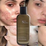 Acne Solutions Factory - Sensitive Skin Gentle