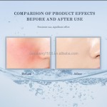 Goat Milk Soap Manufacturer - Hyaluronic Acid