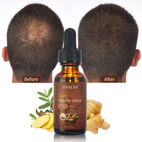 Hair Growth Oil Supplier - Private Label Ginger Scalp Repair Regrowth