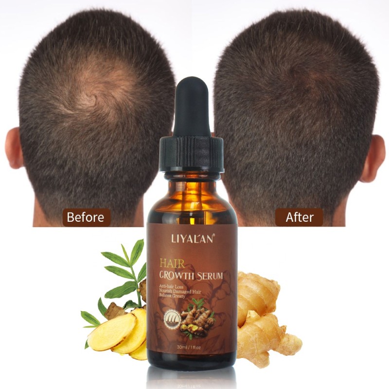 Hair Growth Oil Supplier - Private Label Ginger Scalp Repair Regrowth