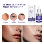Face Serum Supplier - Private Label Vitamin B3 Brightening Anti-Acne