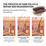 Hair Growth Oil Supplier - Private Label Ginger Scalp Repair Regrowth