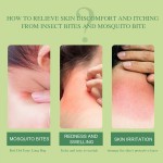 Itching Balm Supplier - Natural Extract