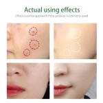 Acne Cleanser Manufacturer - Green Tea Tree