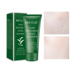 Acne Cleanser Manufacturer - Green Tea Tree