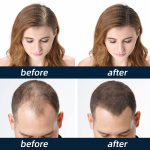 Teeth Whitening Manufacturer - Color Correct