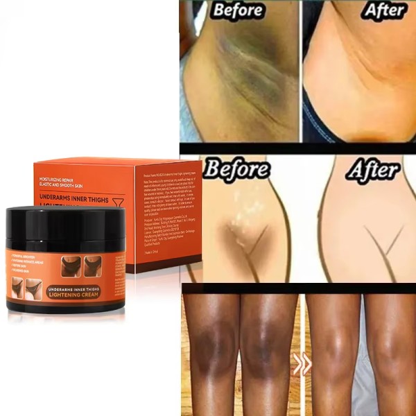 Body Lightening Cream Factory - OEM ODM Herbal Desalination