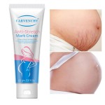 Stretch Mark Cream Manufacturer - OEM Custom Pregnancy Repair