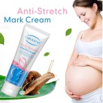 Stretch Mark Cream Manufacturer - OEM Custom Pregnancy Repair