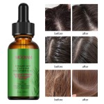 Hair Oil Supplier - OEM Biotin Rosemary Promote Growth Strengthen