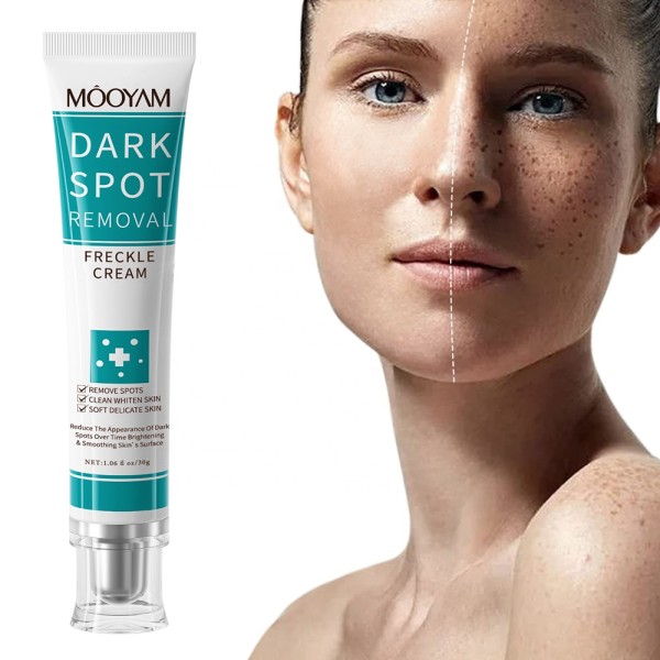 Whitening Cream Manufacturer - OEM Strong Freckle Melasma Melanin Remover