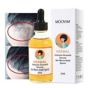 Hair Oil Supplier - OEM Wholesale Hair Loss Treatment Fast Growth